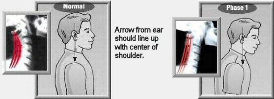 Posture-and-Your-Health_img_2 Posture-and-Your-Health_img_2