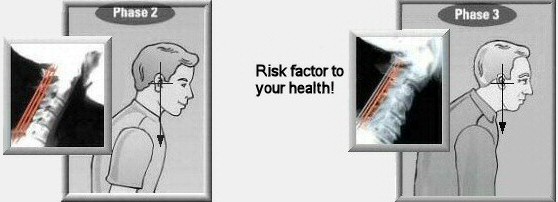Posture-and-Your-Health_img_4 Posture-and-Your-Health_img_4